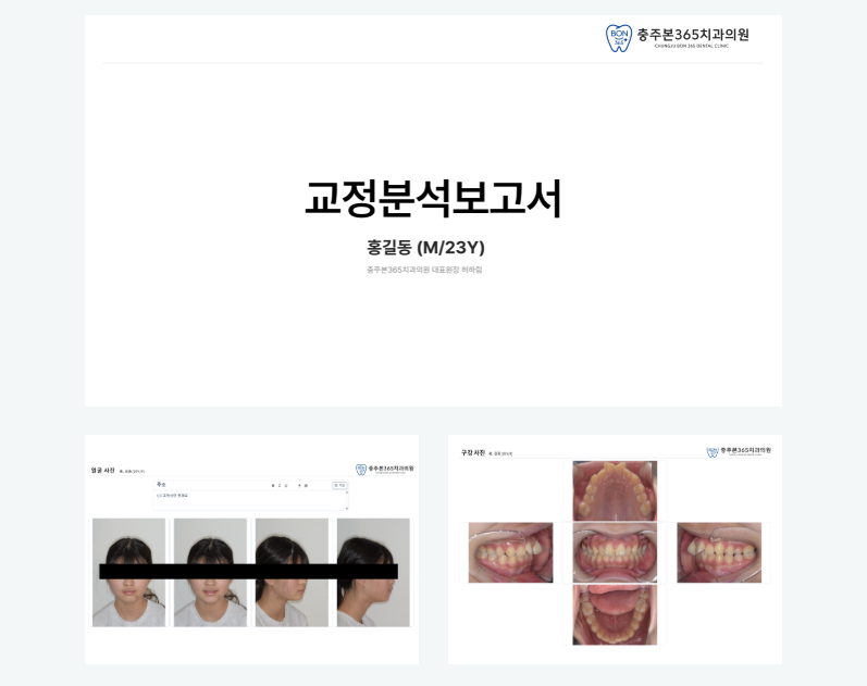 맞춤형 교정 분석 보고서
