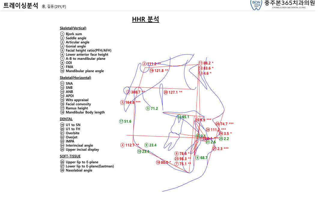 서브 이미지 4
