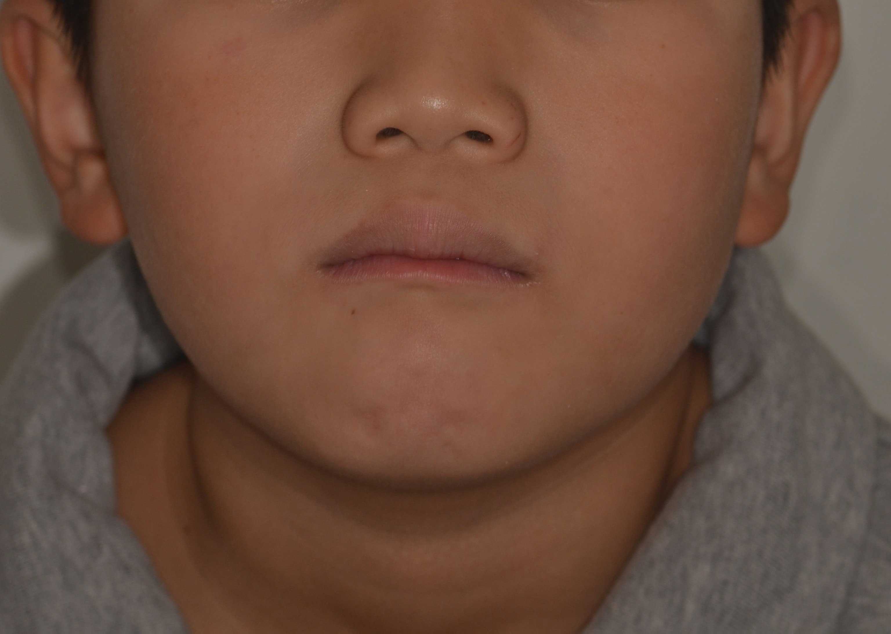 Before