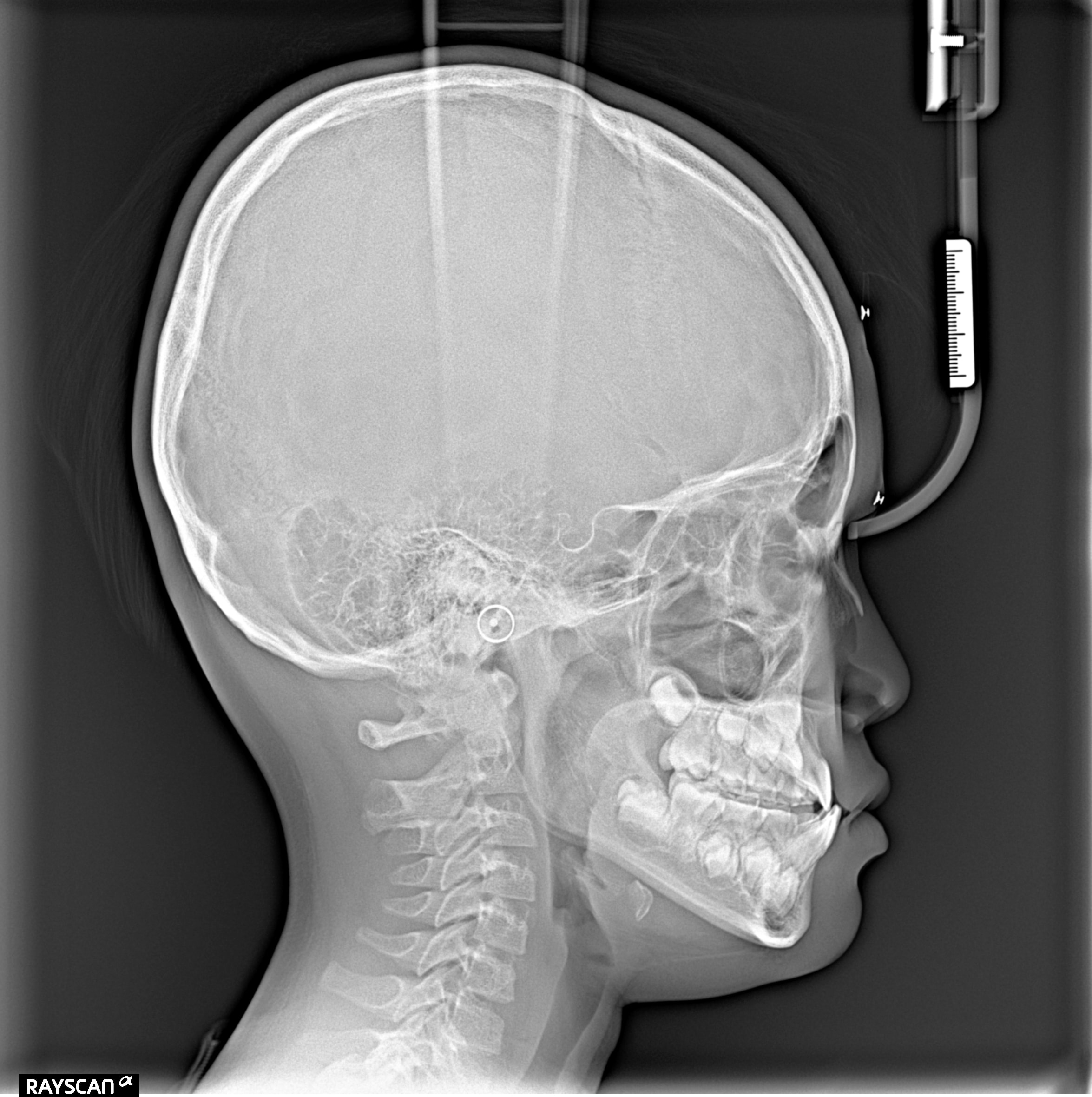 Before Treatment