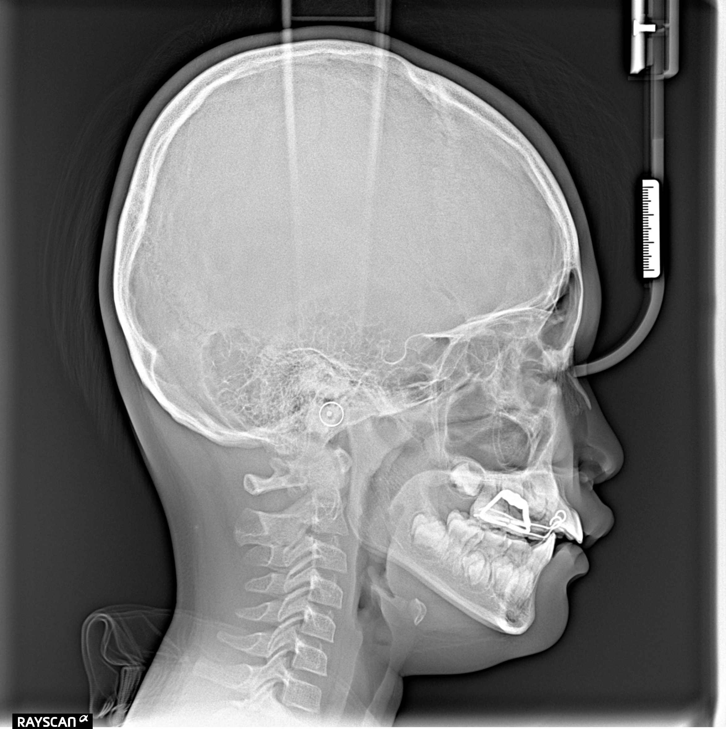 After Treatment
