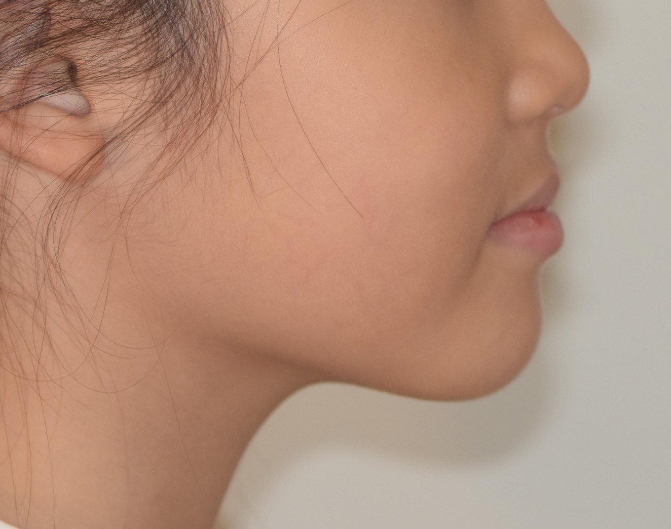 Before