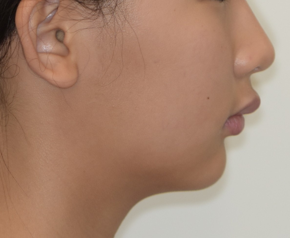 Before