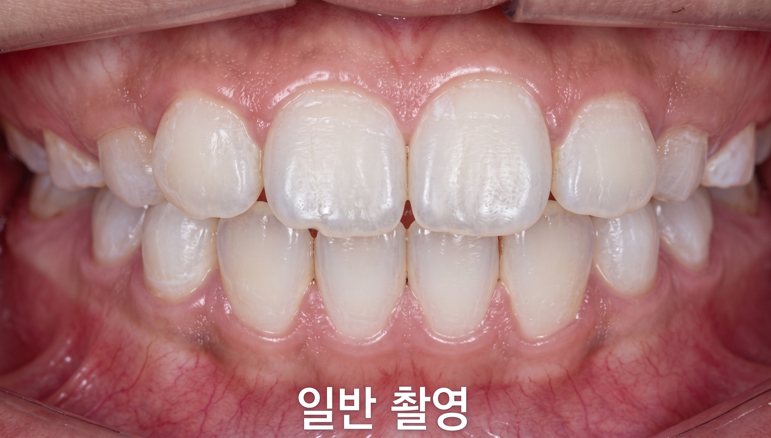 일반 육안 진단