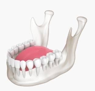 턱관절 3D 모델